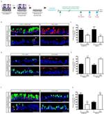 FOXJ1 Antibody in Immunohistochemistry (IHC)