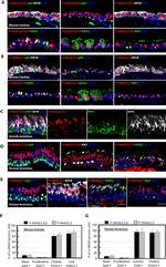 FOXJ1 Antibody in Immunohistochemistry (IHC)