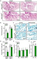 FOXP3 Antibody in Immunohistochemistry (IHC)