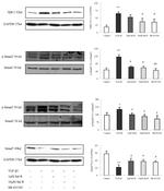 SMAD3 Antibody in Western Blot (WB)