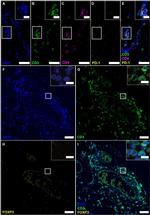 FOXP3 Antibody in Immunohistochemistry, Immunohistochemistry (Paraffin) (IHC, IHC (P))