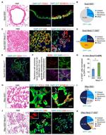 FOXJ1 Antibody in Immunohistochemistry (IHC)