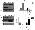 Bcl-2 Antibody in Western Blot (WB)