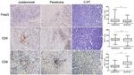 FOXP3 Antibody in Immunohistochemistry (IHC)