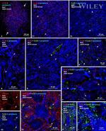 Connexin 26 Antibody in Immunohistochemistry (IHC)