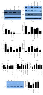 VDR Antibody in Western Blot (WB)