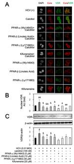 VDR Antibody in Western Blot, Immunocytochemistry (WB, ICC/IF)