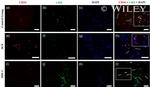 CD117 (c-Kit) Antibody in Immunocytochemistry (ICC/IF)