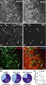 Ki-67 Antibody in Immunocytochemistry, Immunohistochemistry (ICC/IF, IHC)