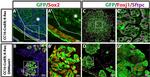 FOXJ1 Antibody in Immunohistochemistry (IHC)