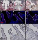 HIF1A Antibody in Immunohistochemistry (IHC)