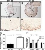 HIF1A Antibody in Immunohistochemistry (IHC)