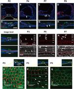 Connexin 26 Antibody in Immunohistochemistry (IHC)