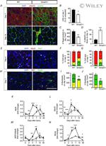 Ki-67 Antibody in Immunohistochemistry (Frozen) (IHC (F))