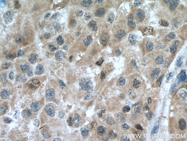 CDK2 Antibody in Immunohistochemistry (Paraffin) (IHC (P))