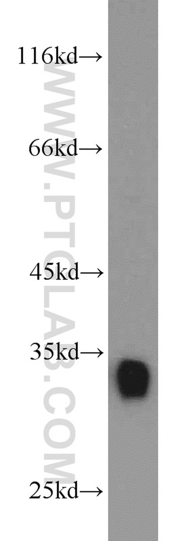 CDK2 Antibody in Western Blot (WB)