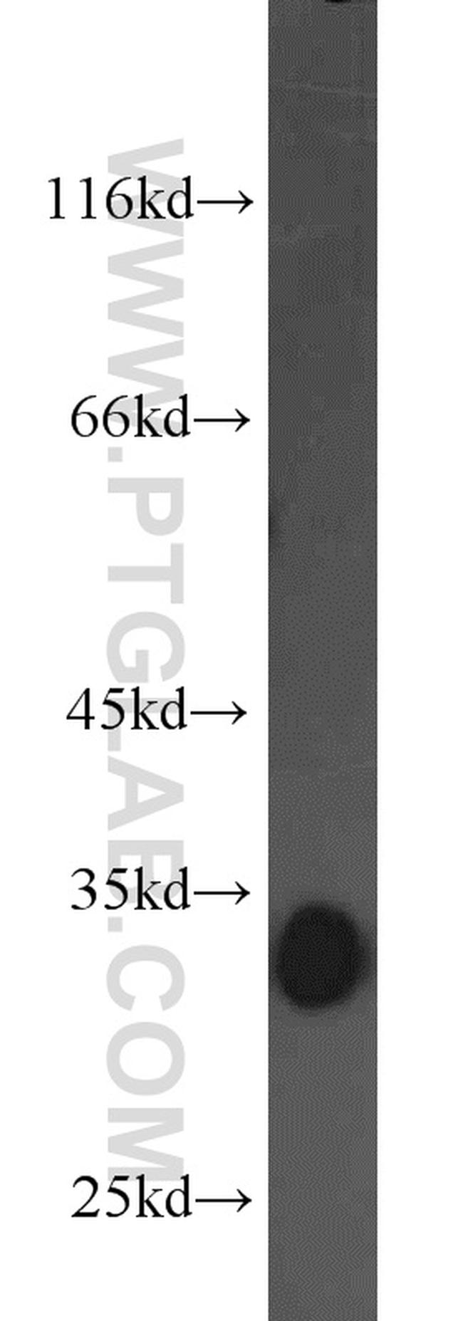 CDK2 Antibody in Western Blot (WB)