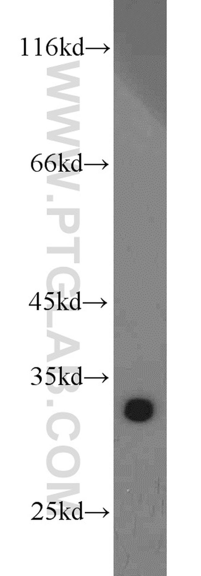 CDK2 Antibody in Western Blot (WB)