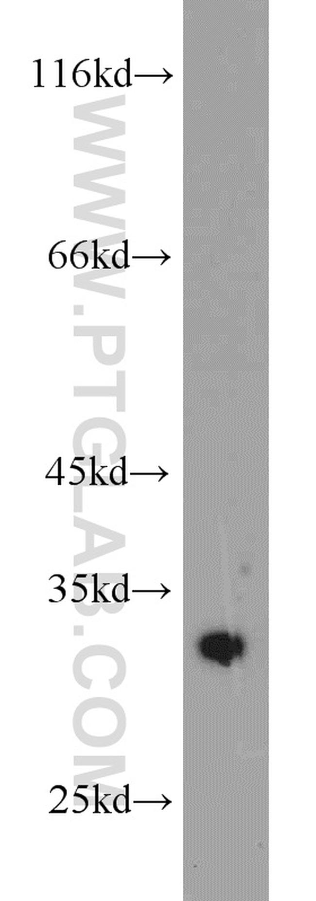 CDK2 Antibody in Western Blot (WB)