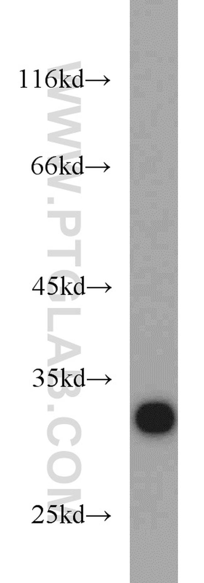 CDK2 Antibody in Western Blot (WB)