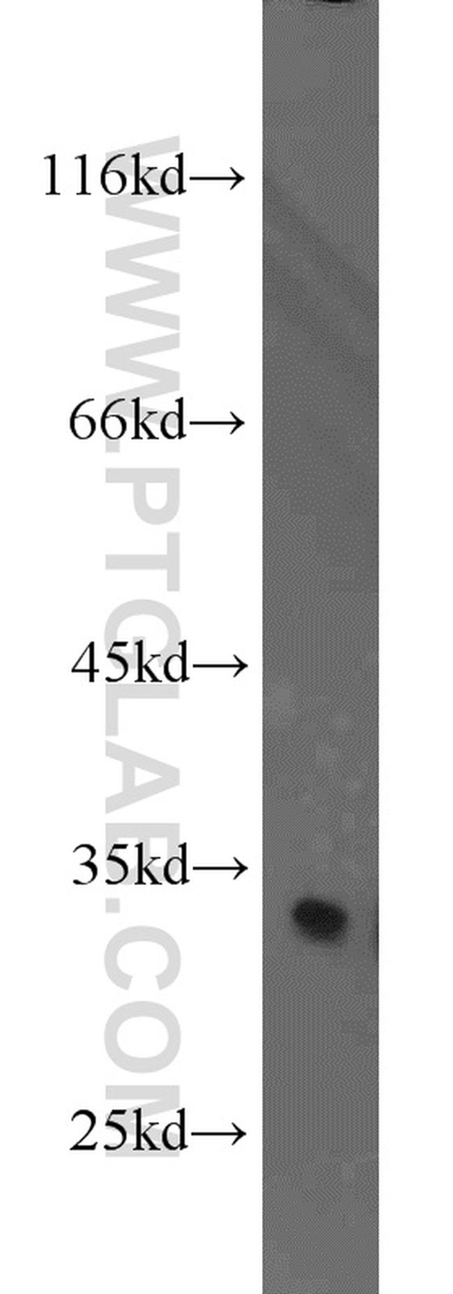 CDK2 Antibody in Western Blot (WB)