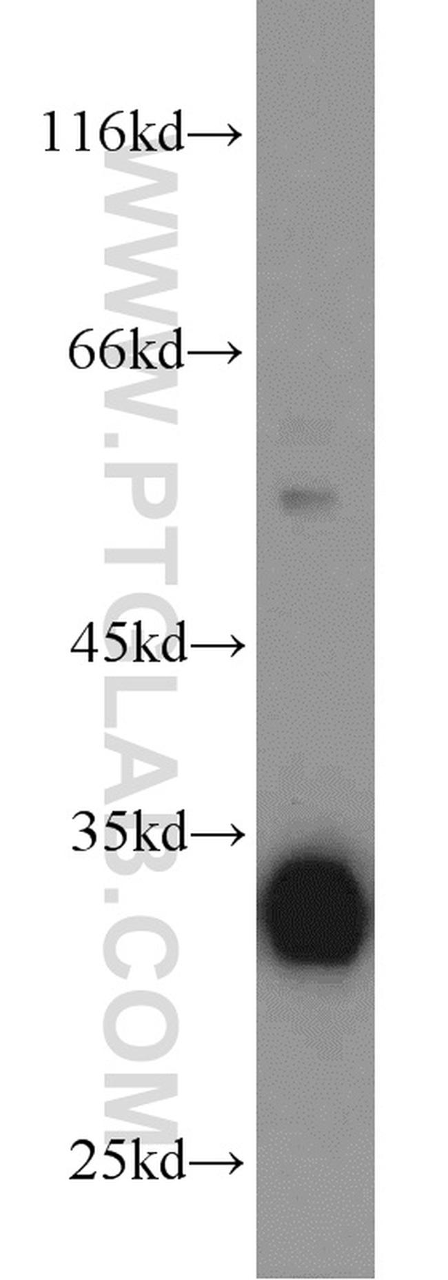 CDK2 Antibody in Western Blot (WB)