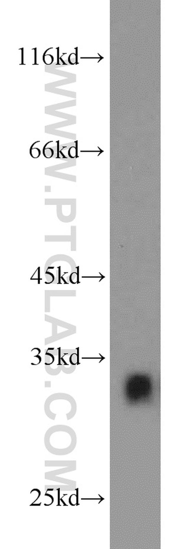 CDK2 Antibody in Western Blot (WB)