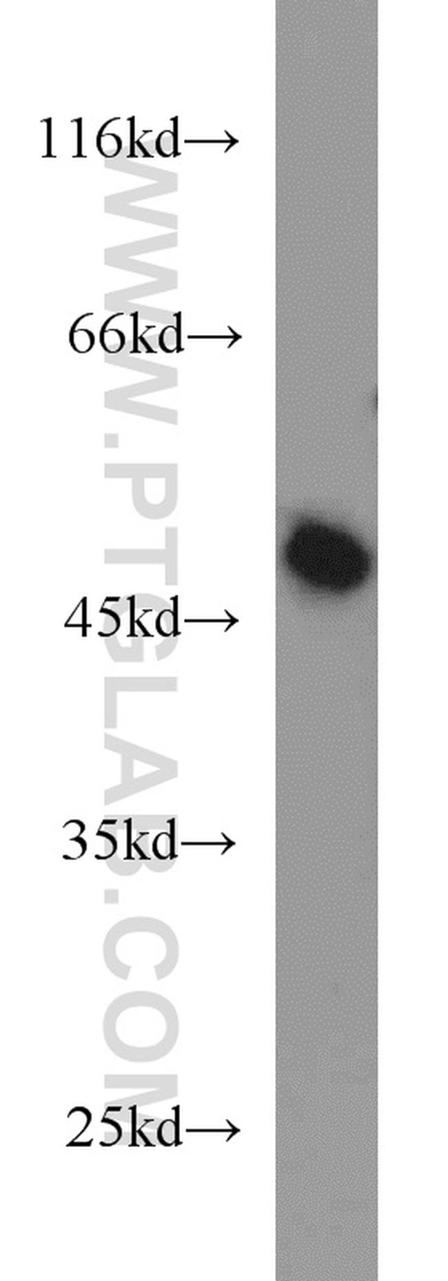 ATG5 Antibody in Western Blot (WB)