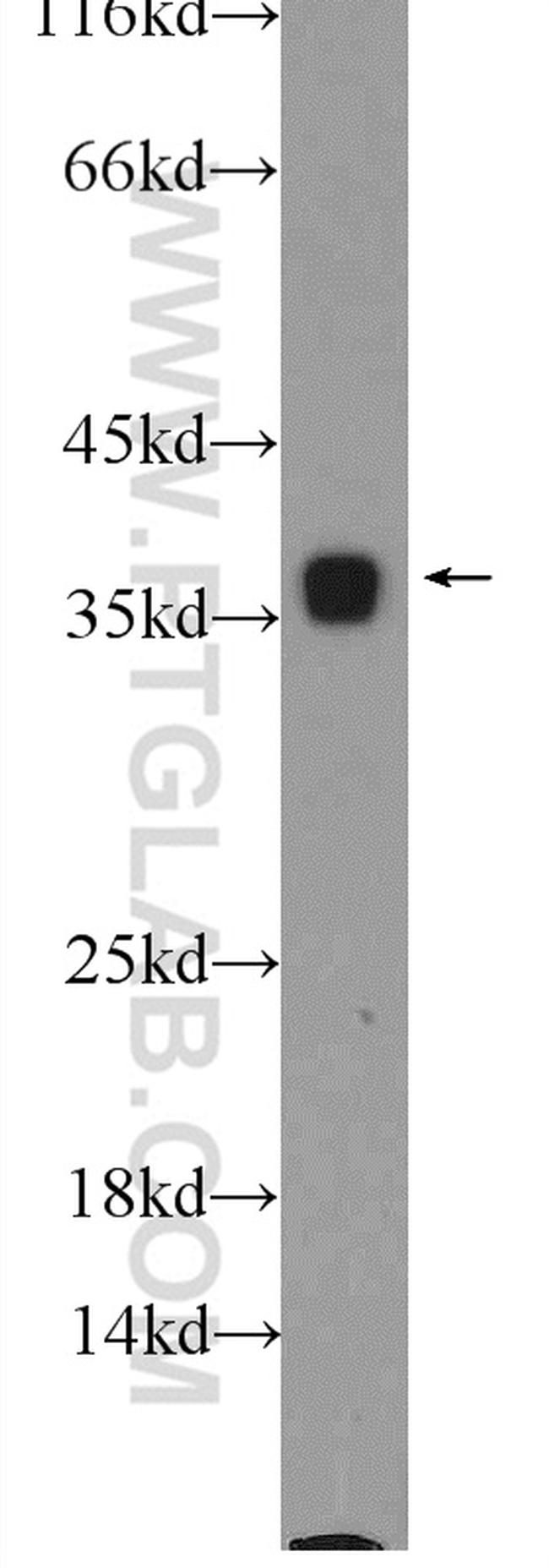 PCNA Antibody in Western Blot (WB)