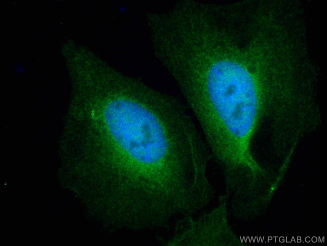 STAT3 Antibody in Immunocytochemistry (ICC/IF)