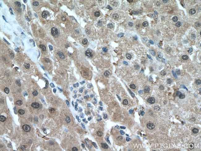 SOD1 Antibody in Immunohistochemistry (Paraffin) (IHC (P))