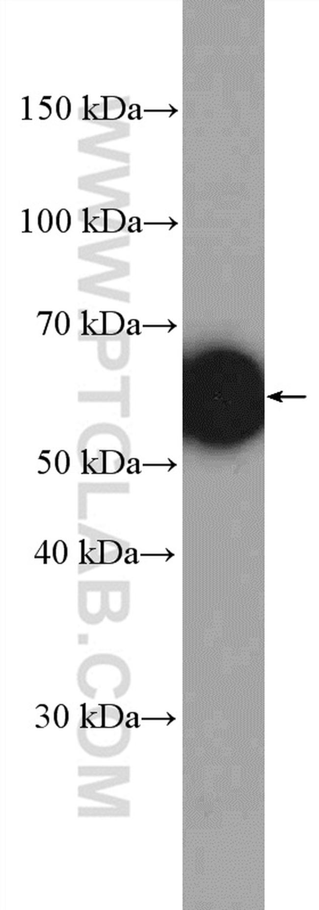 Lamin A/C Antibody in Western Blot (WB)