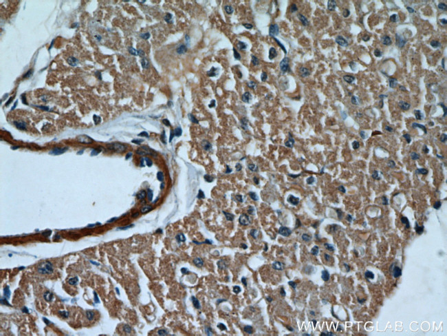 Caspase 9/p35/p10 Antibody in Immunohistochemistry (Paraffin) (IHC (P))