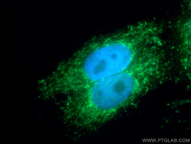 KMO Antibody in Immunocytochemistry (ICC/IF)