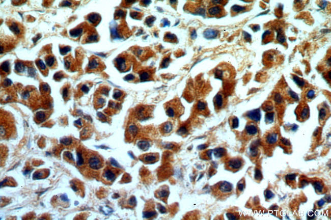 KMO Antibody in Immunohistochemistry (Paraffin) (IHC (P))