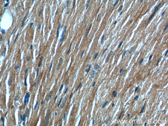 KMO Antibody in Immunohistochemistry (Paraffin) (IHC (P))