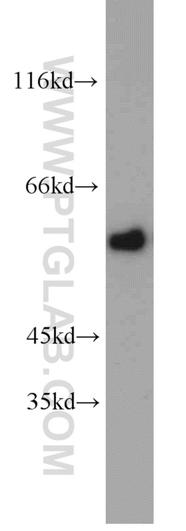 KMO Antibody in Western Blot (WB)