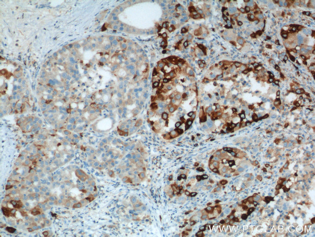 HO-1/HMOX1 Antibody in Immunohistochemistry (Paraffin) (IHC (P))