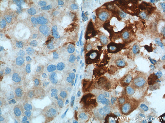 HO-1/HMOX1 Antibody in Immunohistochemistry (Paraffin) (IHC (P))