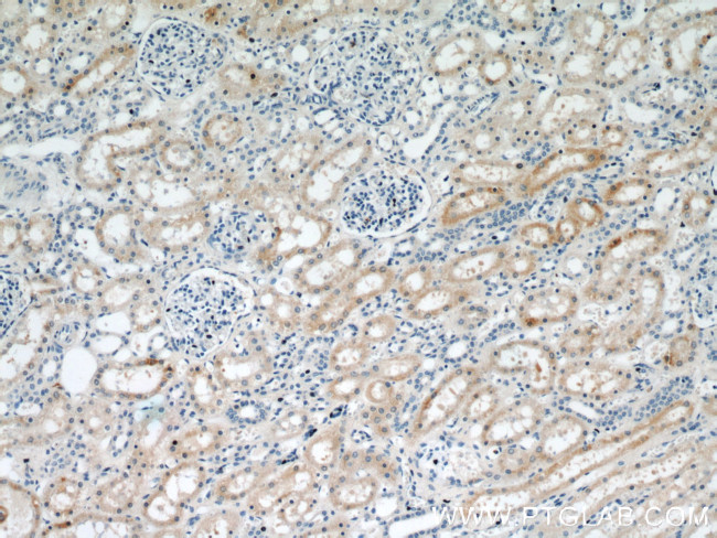 HO-1/HMOX1 Antibody in Immunohistochemistry (Paraffin) (IHC (P))