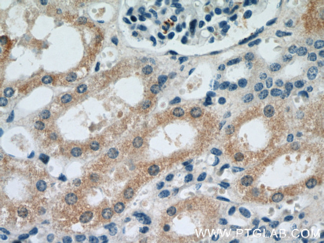 HO-1/HMOX1 Antibody in Immunohistochemistry (Paraffin) (IHC (P))