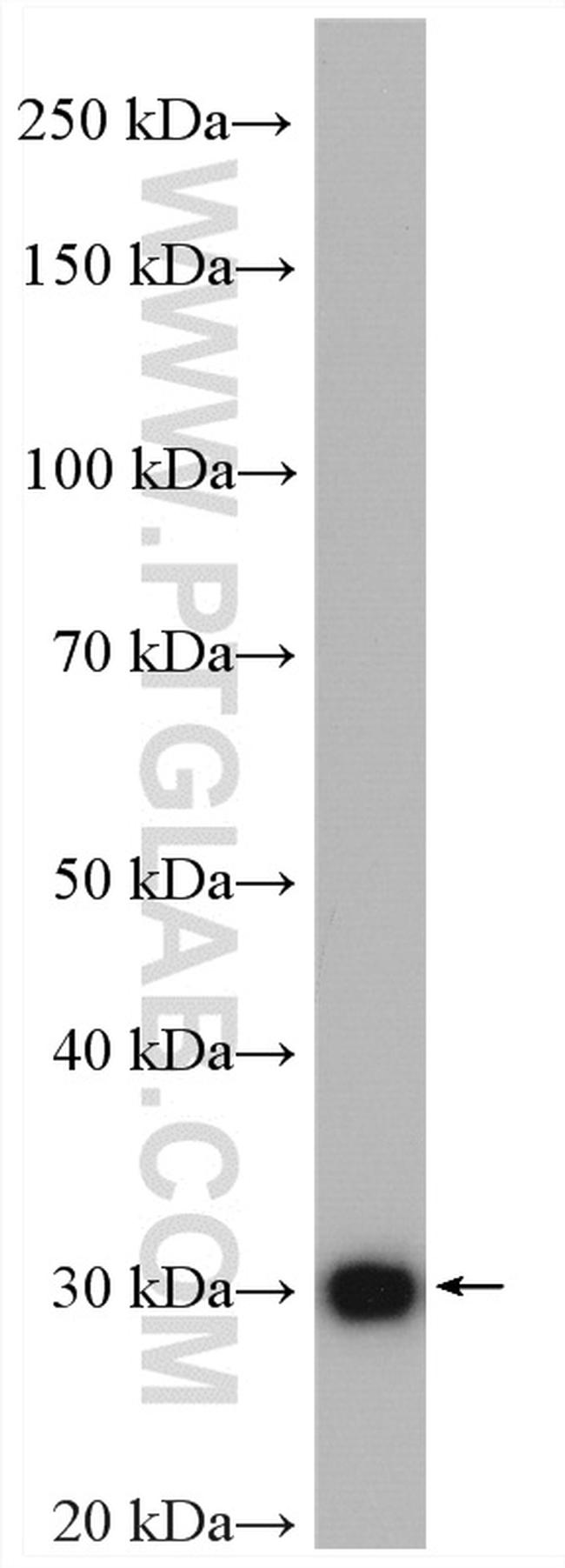 HO-1/HMOX1 Antibody in Western Blot (WB)