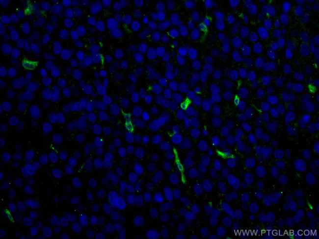 HO-1/HMOX1 Antibody in Immunohistochemistry (PFA fixed) (IHC (PFA))