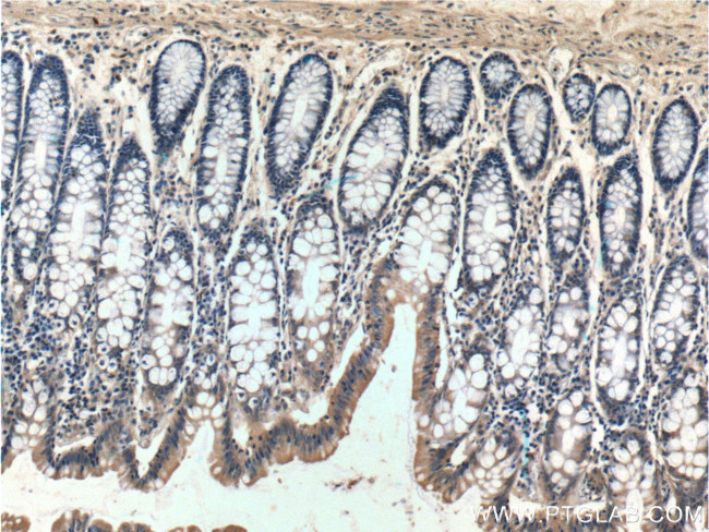 Bcl-XL Antibody in Immunohistochemistry (Paraffin) (IHC (P))