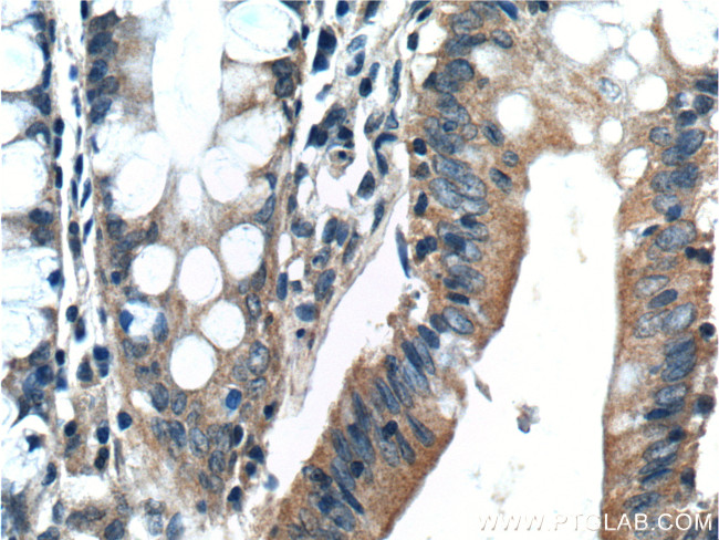 Bcl-XL Antibody in Immunohistochemistry (Paraffin) (IHC (P))