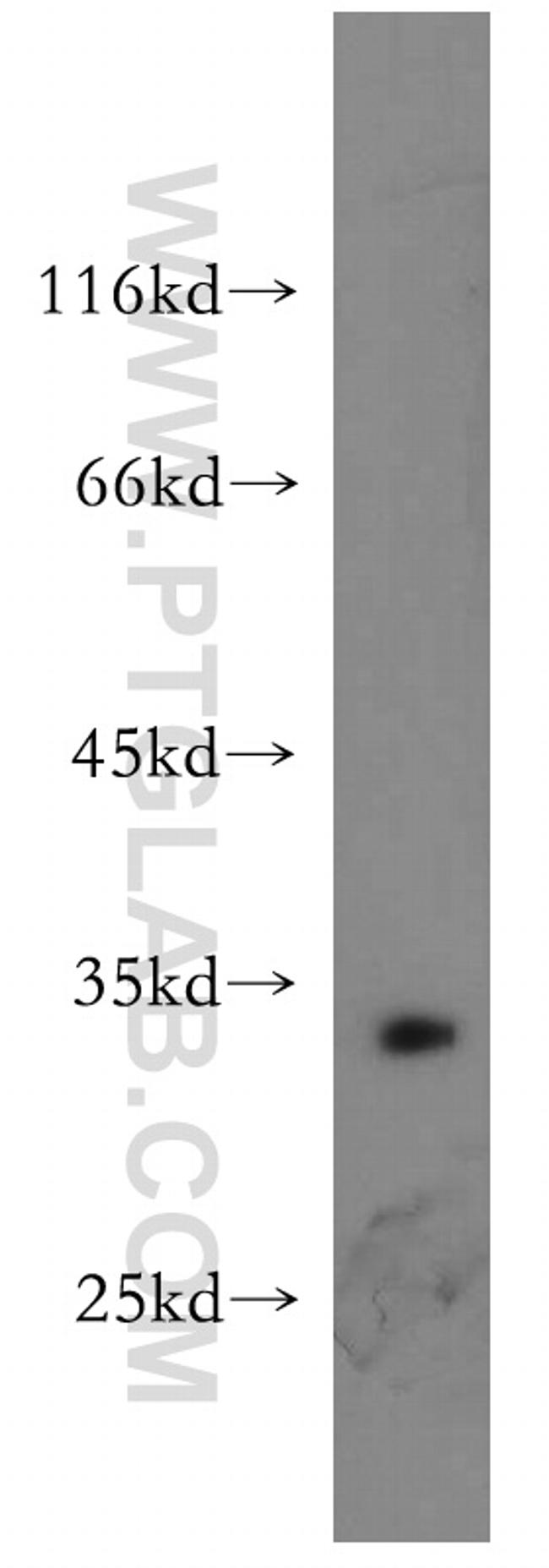 Bcl-XL Antibody in Western Blot (WB)