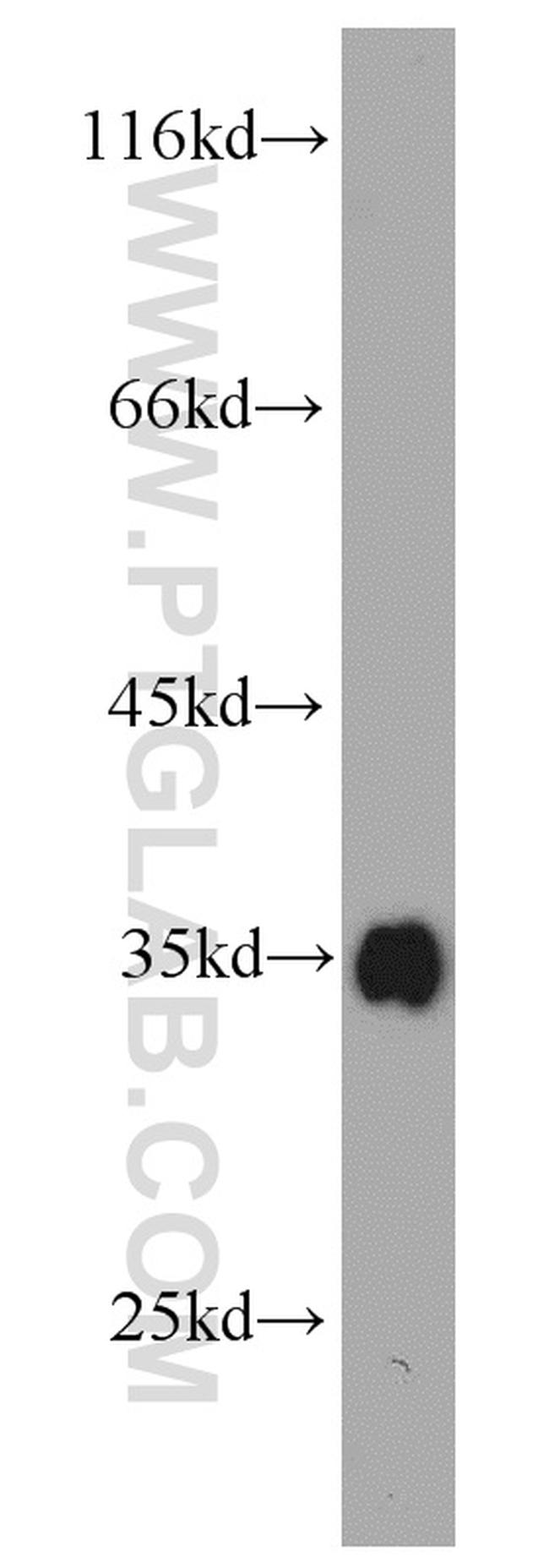 Bcl-XL Antibody in Western Blot (WB)