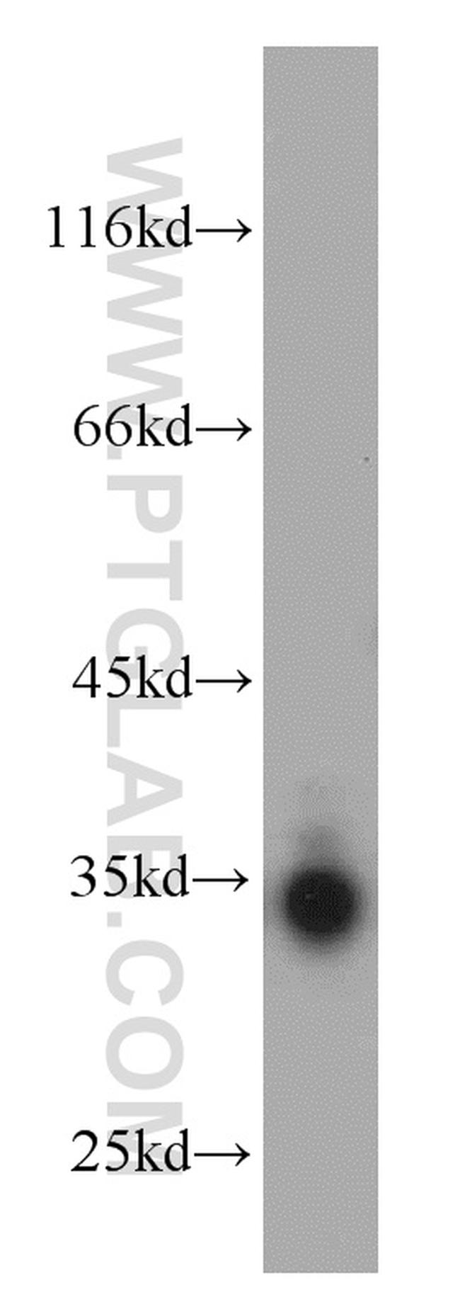 Bcl-XL Antibody in Western Blot (WB)