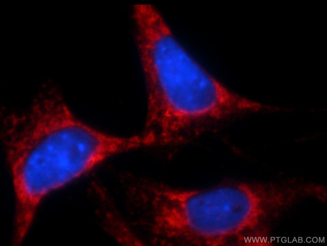 Bcl-XL Antibody in Immunocytochemistry (ICC/IF)