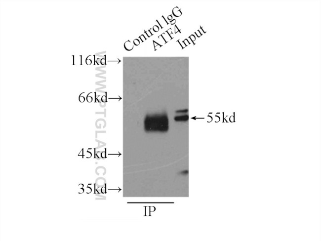 ATF4 Antibody in Immunoprecipitation (IP)